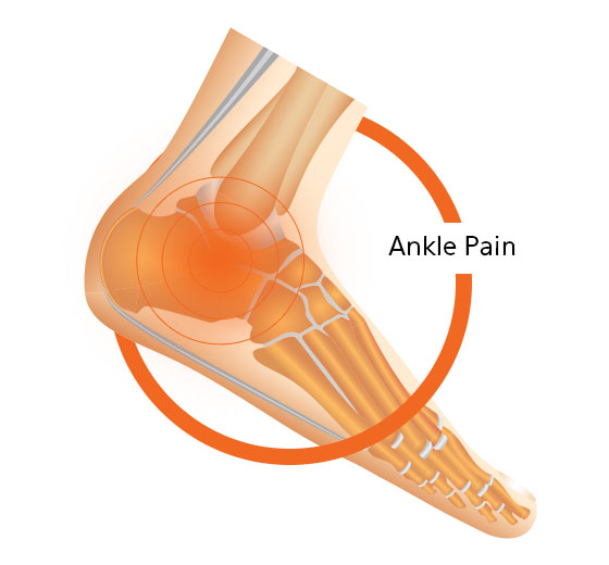 Ankle Pain Diagram